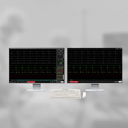 EP-TRACER 2 STATIONARY